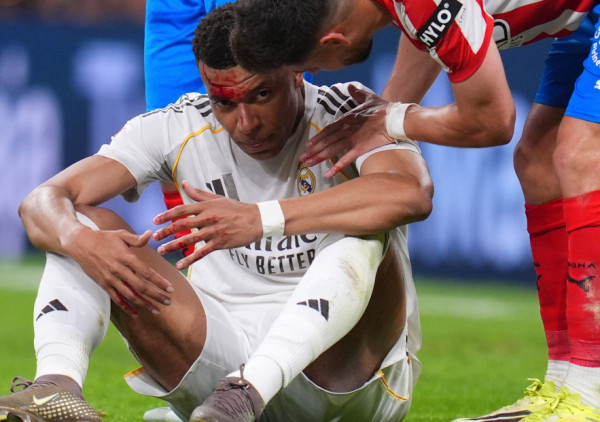 Real opet besan na sudiju: To je penal ovde i na Mesecu