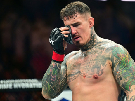 Aspinal potvrdio velike očne probleme nakon duela sa Ganom: Šampionu teškaša ustanovljena retka dijagnoza