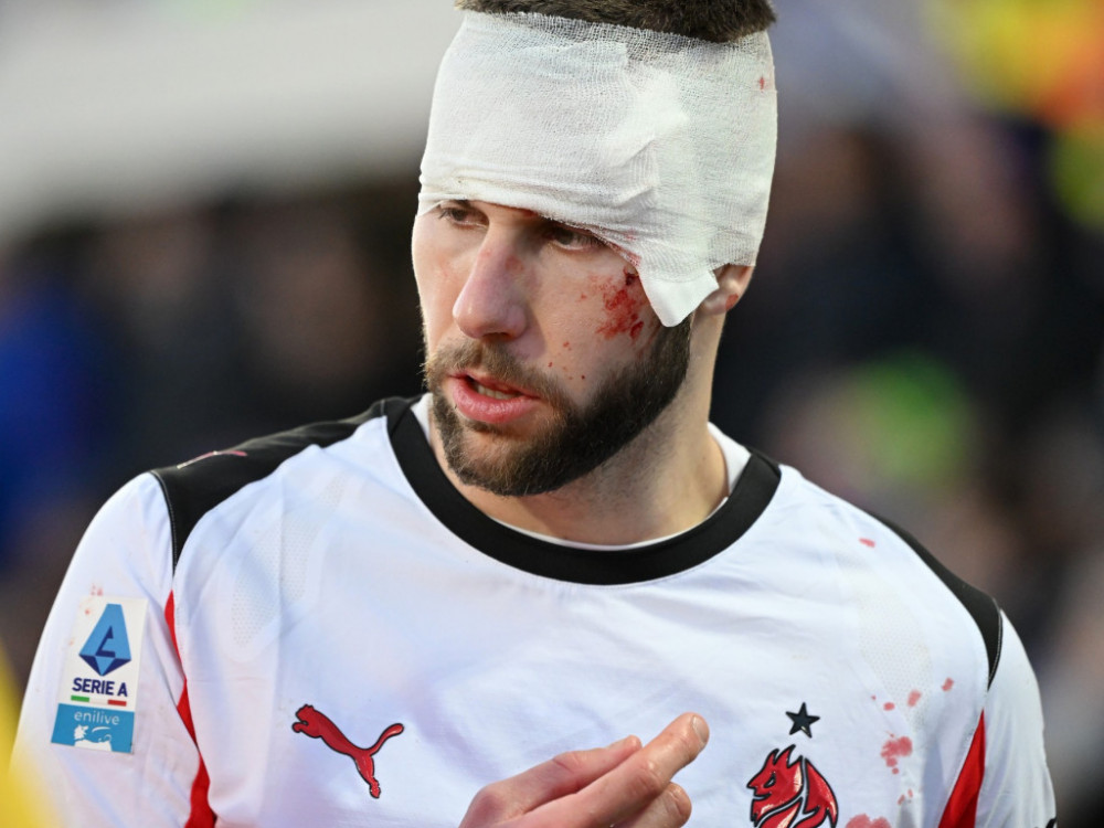 Strahinja Pavlović, fudbaler Milana, posle povrede protiv Fiorentine