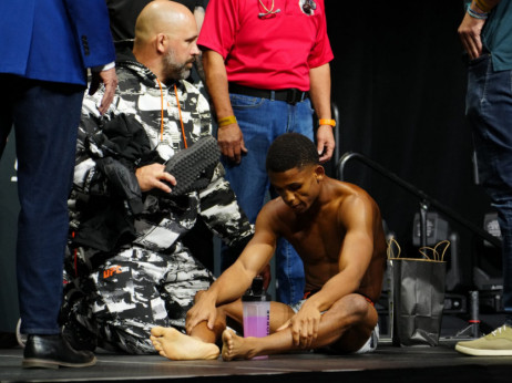 (VIDEO) Nije lako skidati kilažu: UFC borac se onesvestio posle zvaničnog merenja