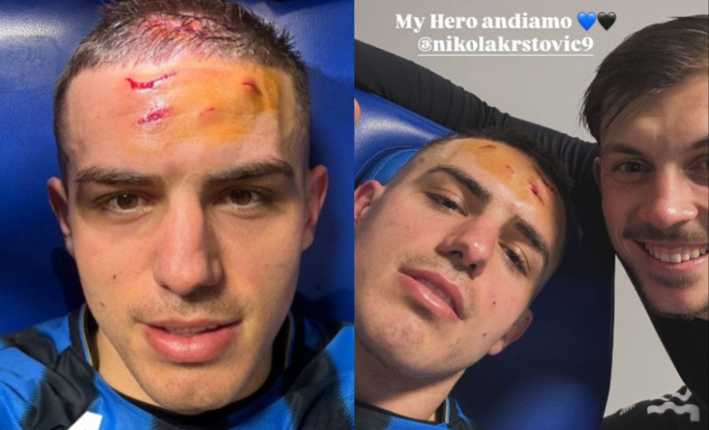 Nikola Krstović sa posekotinama posle Borusije