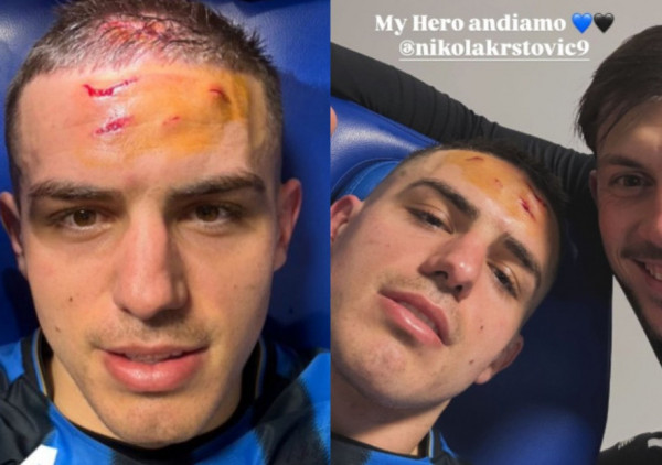 Lazar Samardžić ima svog heroja, a to je izubijani Nikola Krstović