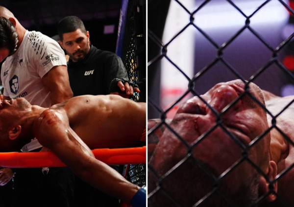 (VIDEO) Uznemirujući snimak sa UFC eventa: Brazilac bez svesti iznesen iz oktagona, niko ne zna šta se dogodilo